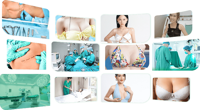 Img Nghe Thuat Tao Hinh Nguc